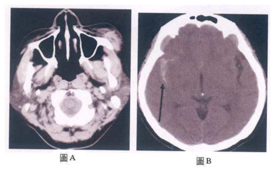 第 74 題附圖
