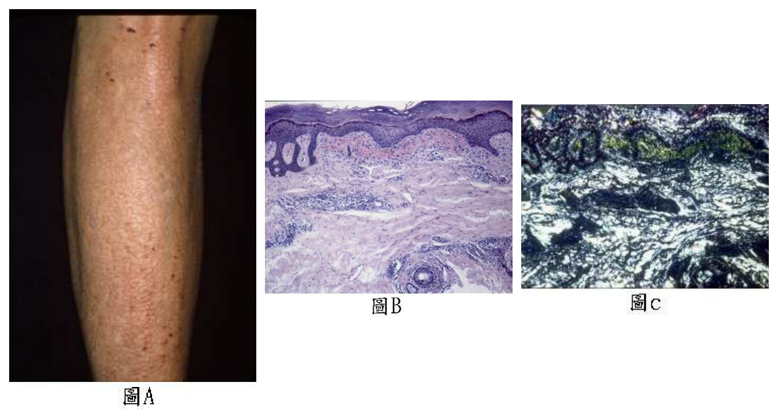 第 36 題附圖