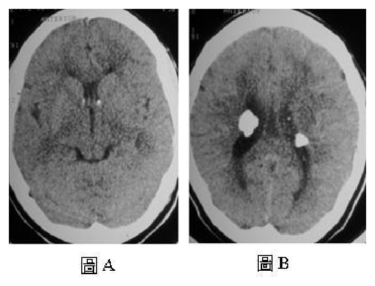 第 74 題附圖