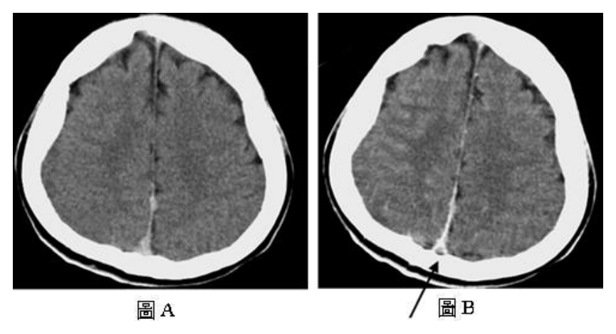 第 75 題附圖