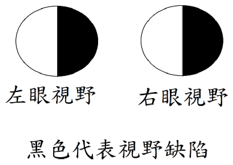 第 13 題附圖