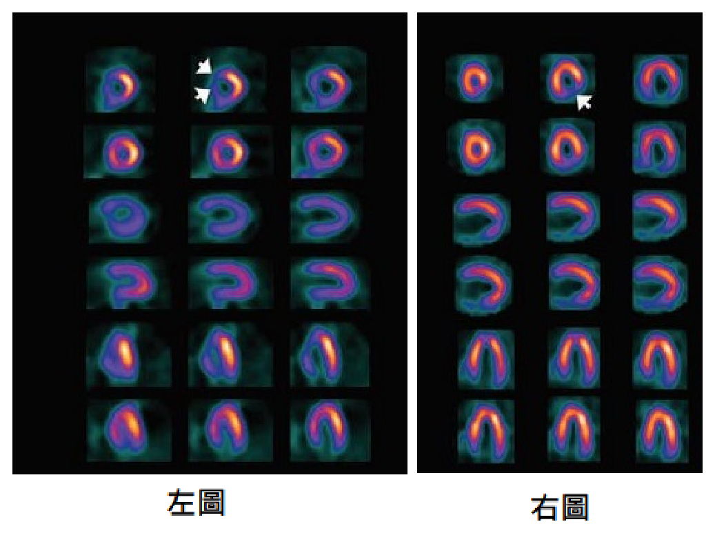 第 14 題附圖