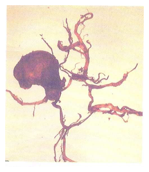 第 100 題附圖